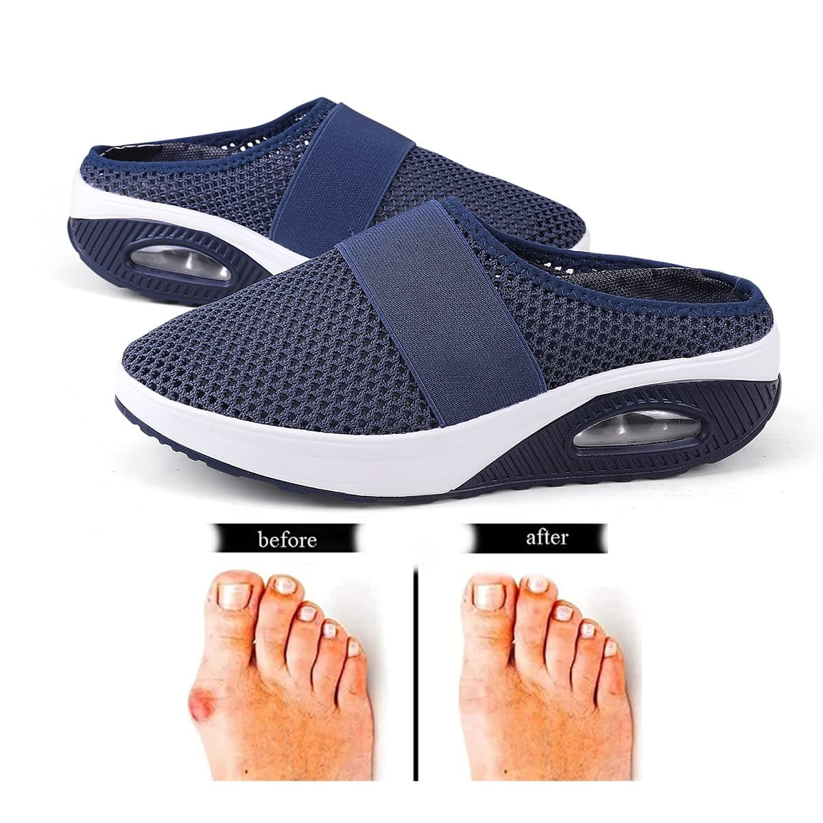 Air Cushion Slip-On Walking Shoes Orthopedic Diabetic Walking Shoes, Best Orthopedic Walking Shoes for Women