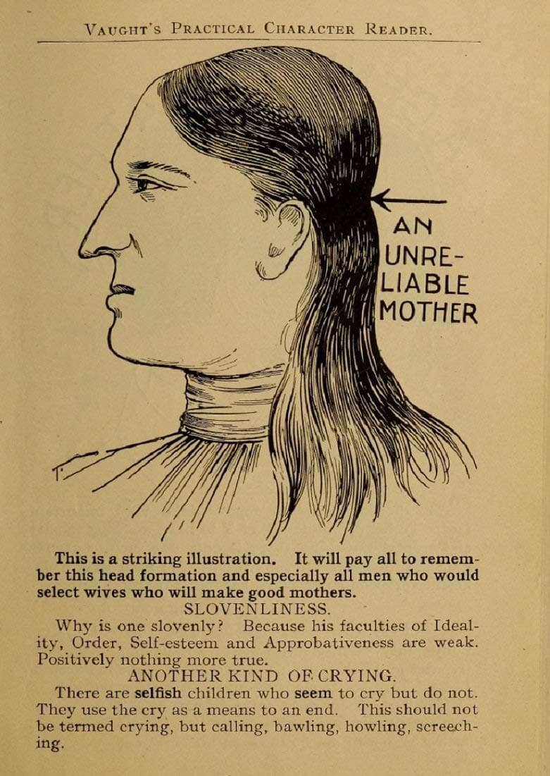 World of Art Global Vintage Anatomy Phrenology 'An Unrealiable Mother', from 'Vaught's Practical Character Reader', U.S.A, 1902, Reproduction 200gsm A3 Vintage Medical Poster